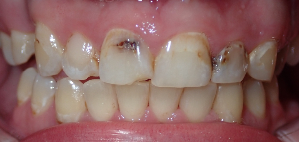 Before